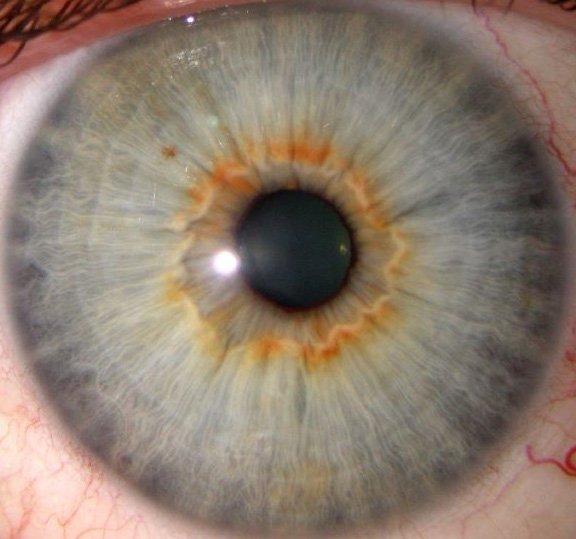Iridología 5