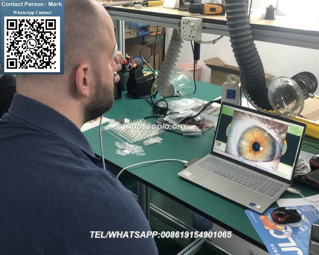 Cose lIridologia 249