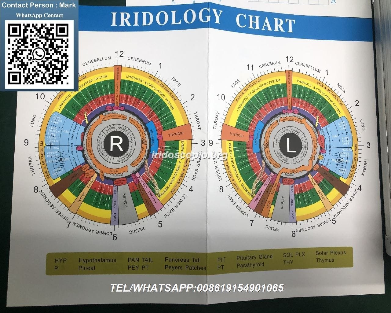 Autorità Dino Lite Iridoscopio: Guida Completa per Professionist 12 Dino Lite Iridoscopio 34