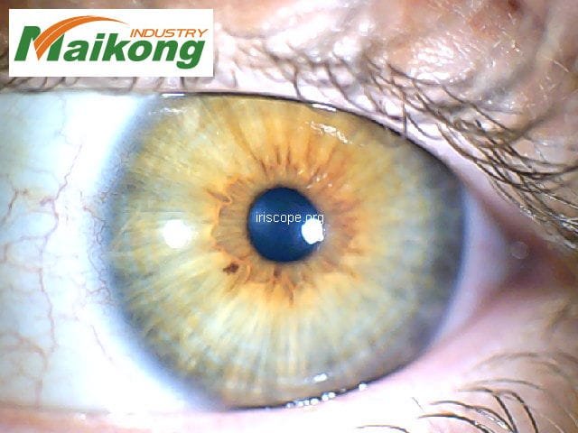 MAIKONG 5MP Iridoscopio Digitale 233