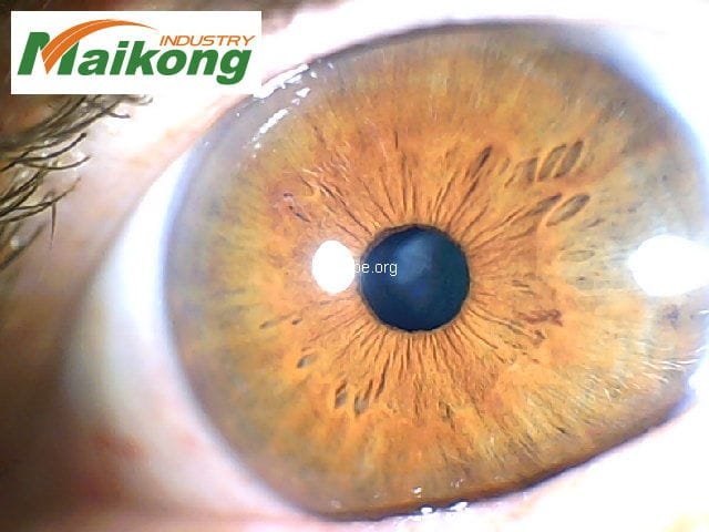 MAIKONG 5MP Iridoscopio Digitale 238