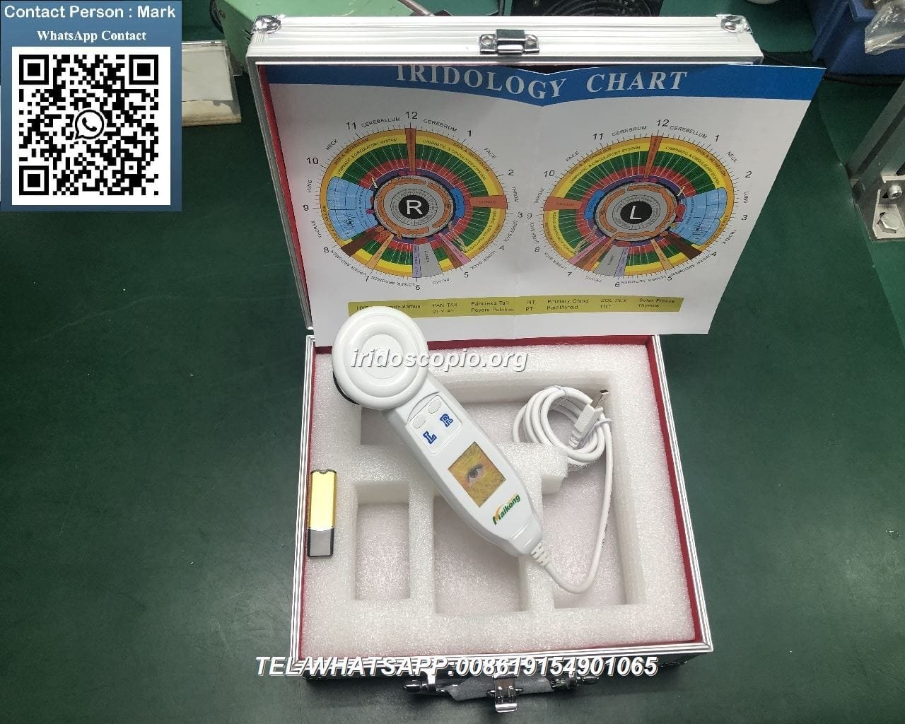 MAIKONG 5MP Iridoscopio Digitale: Guida Completa per Professionisti dell'Iridologia con Analisi Tecnica e Recensioni Globali 4 MAIKONG 5MP Iridoscopio Digitale 24