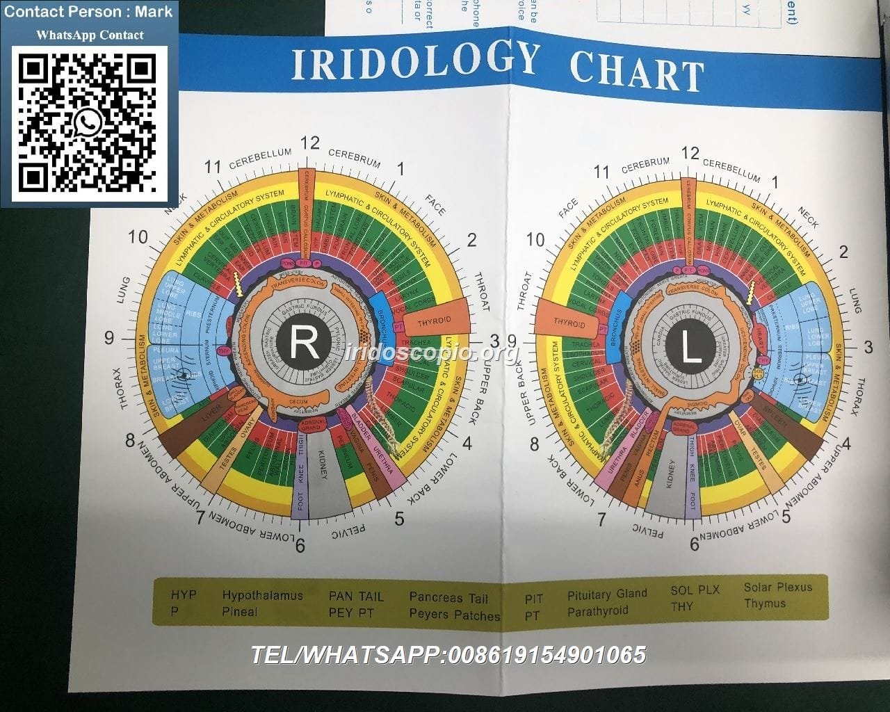 MAIKONG 5MP Iridoscopio Digitale 35