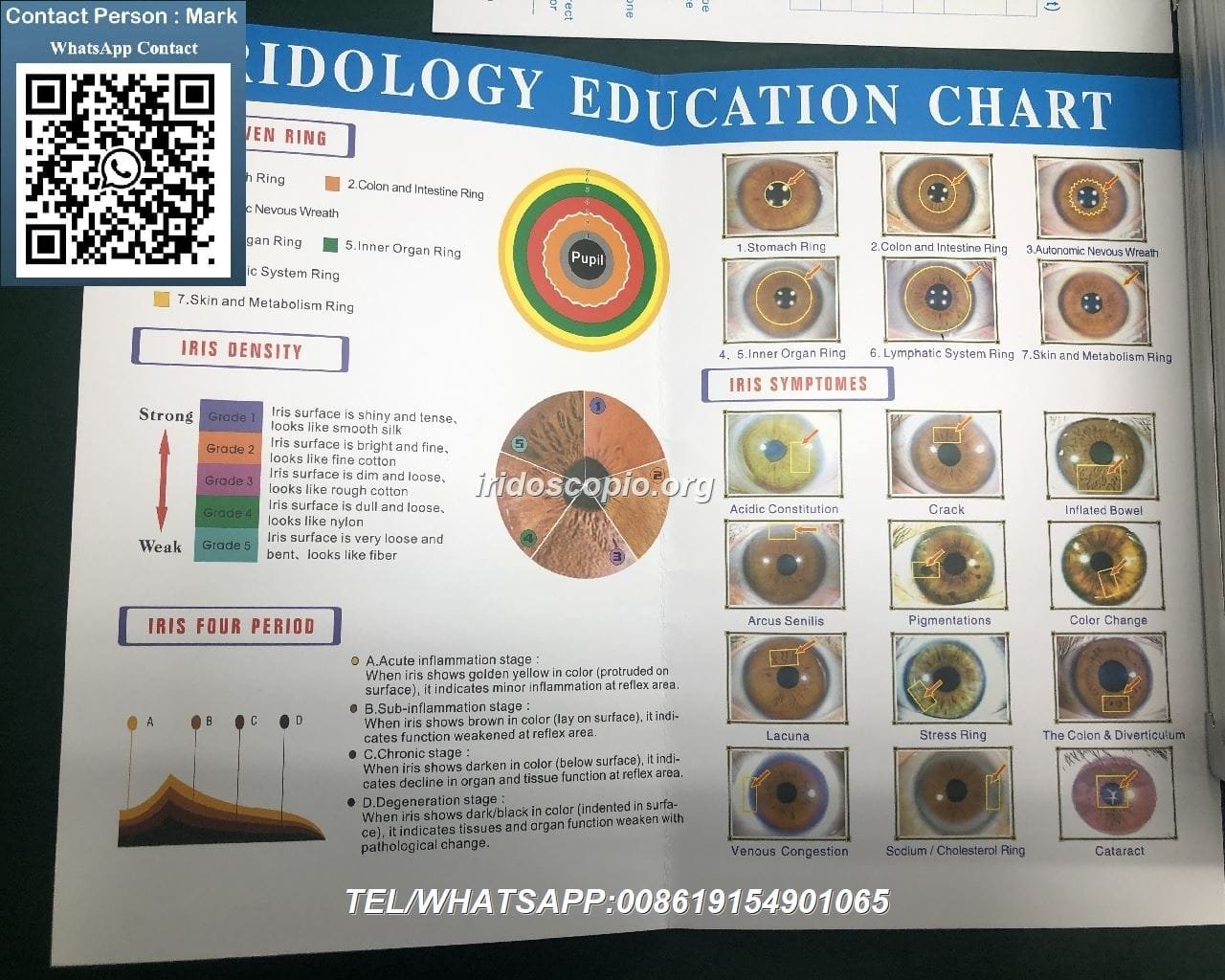 MAIKONG 5MP Iridoscopio Digitale 36