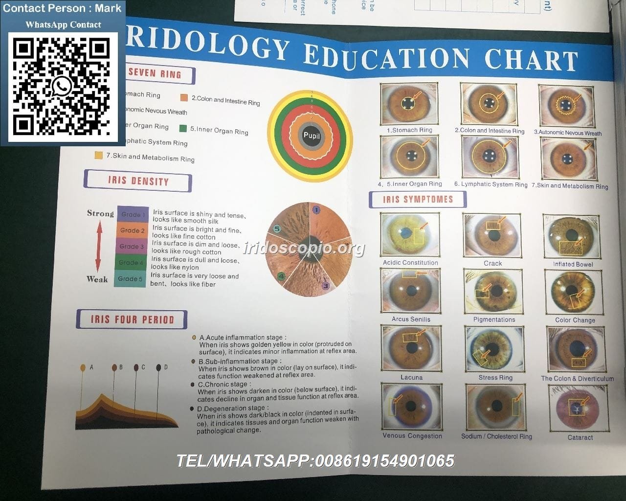 MAIKONG 5MP Iridoscopio Digitale 37