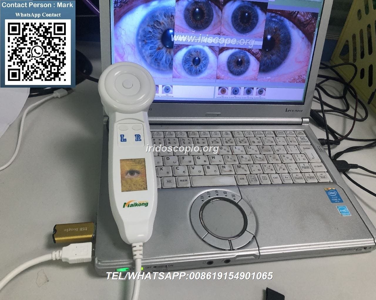 MAIKONG 5MP Iridoscopio Digitale 73