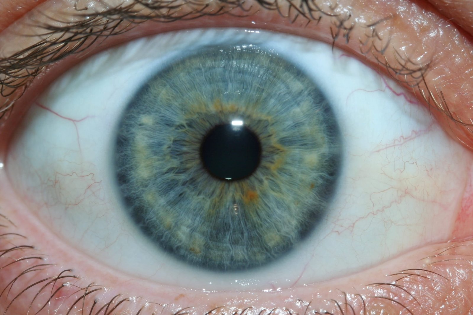 Corso di Iridologia: Guida per Apprendere e Progredire nell'Arte dell'Analisi Iridologica 24 Iridologia