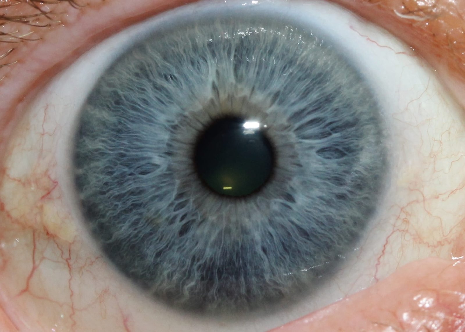 Corso di Iridologia: Guida per Apprendere e Progredire nell'Arte dell'Analisi Iridologica 21 Iridologia