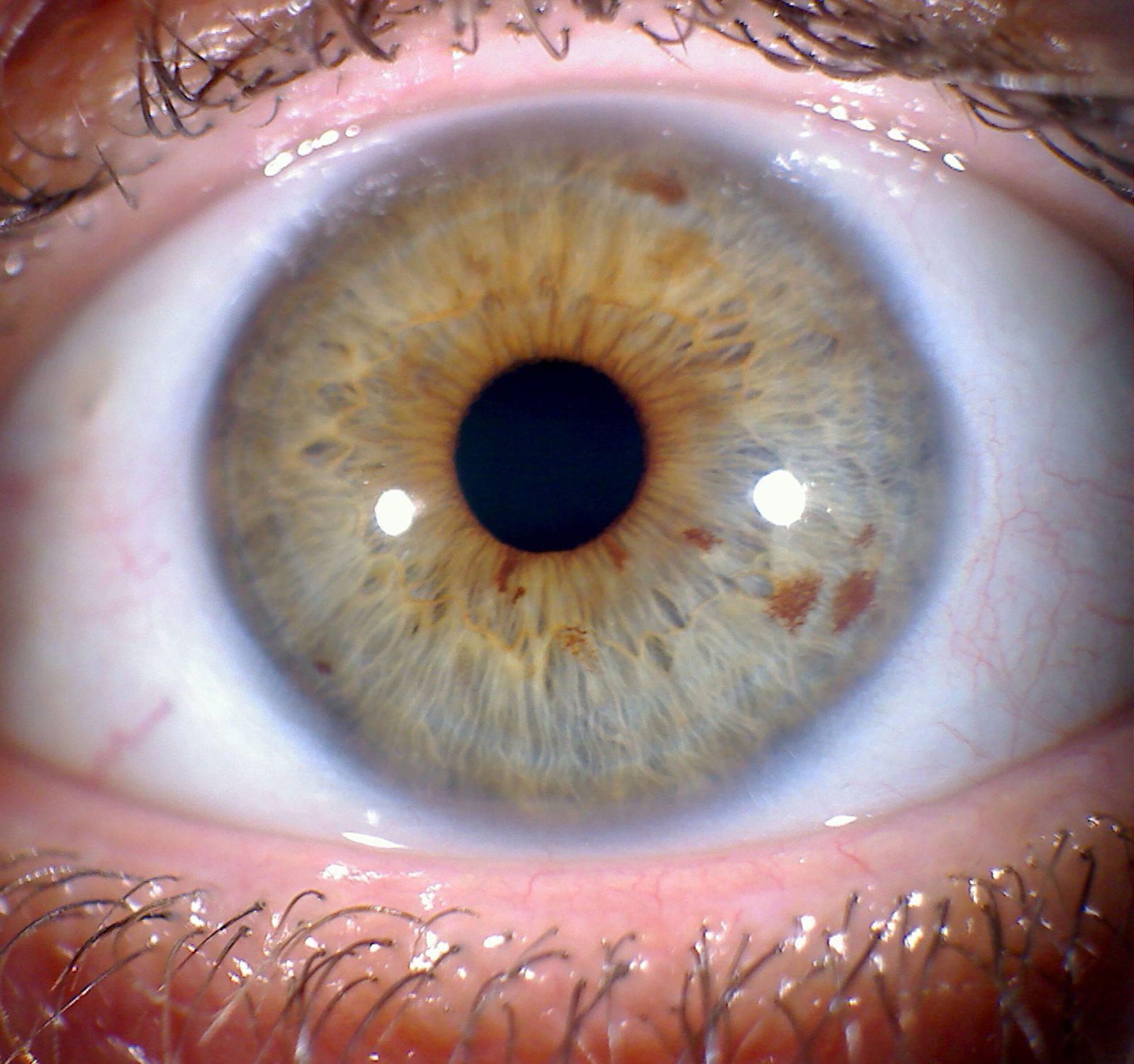 MAIKONG IRIDOLOGY CAMERA 260 scaled