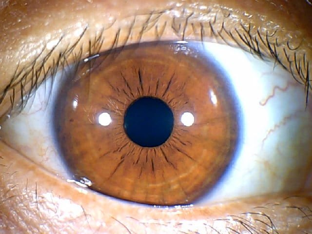 MAIKONG IRIDOLOGY CAMERA 303