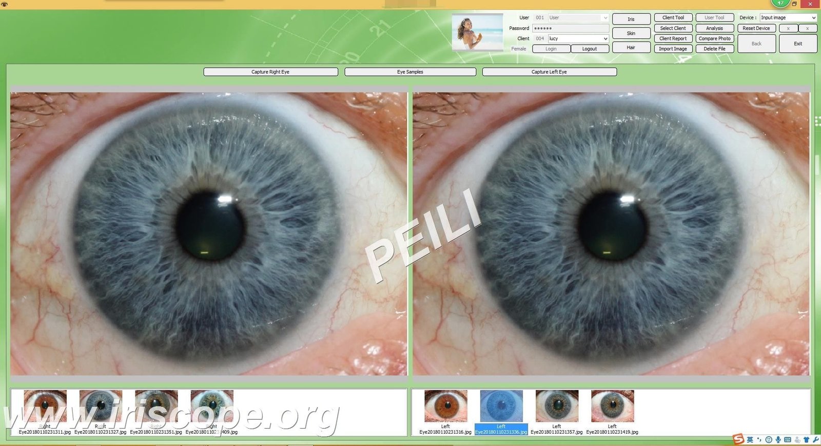 MAIKONG IRIDOLOGY CAMERA 43