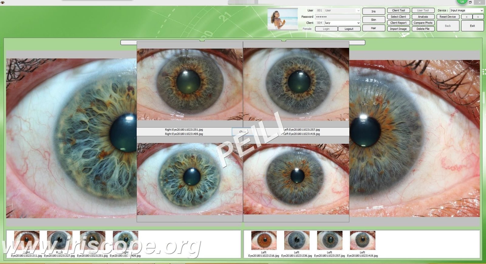 Iridoscopio Professionale 5MP: Fotocamera Digitale per Iridologia e Analisi dell'Occhio 17 MAIKONG IRIDOLOGY CAMERA 47