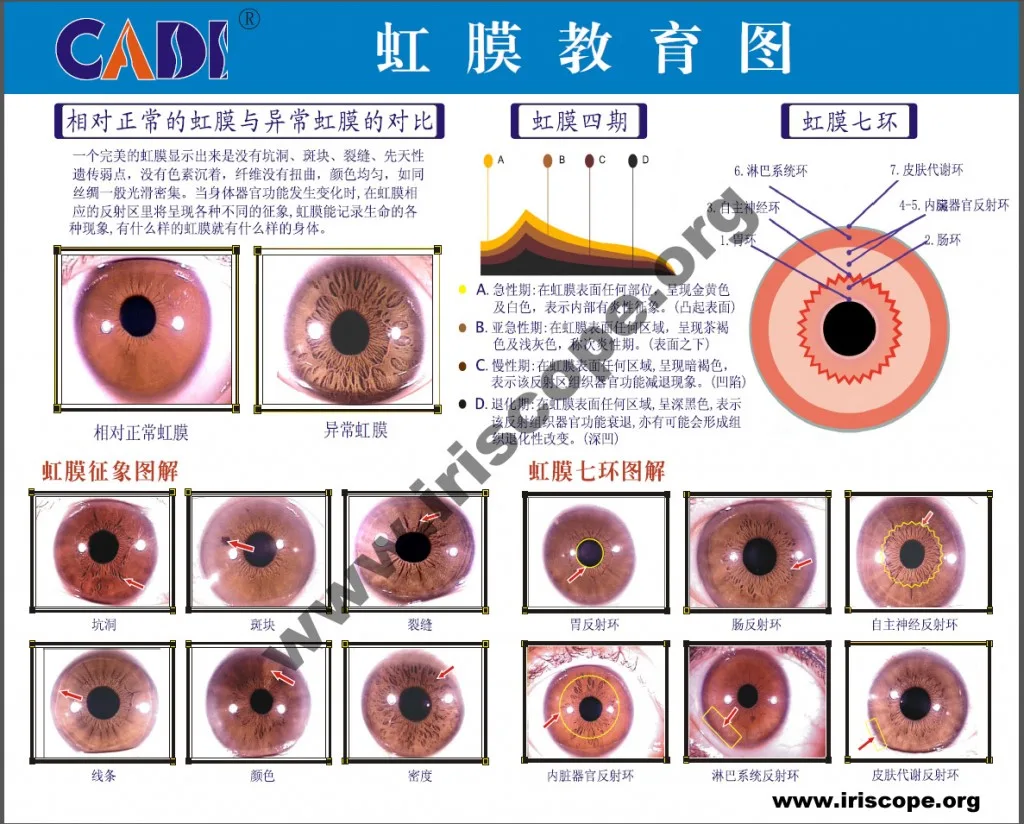 MAPPA IRIDOLOGICA 2 Mappa Iridologica Cinese
