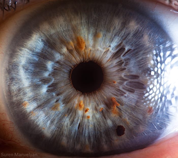 Iridologia 10