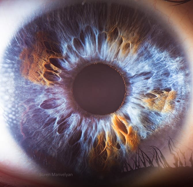 Iridologia 11