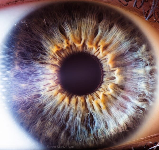 Iridologia 12