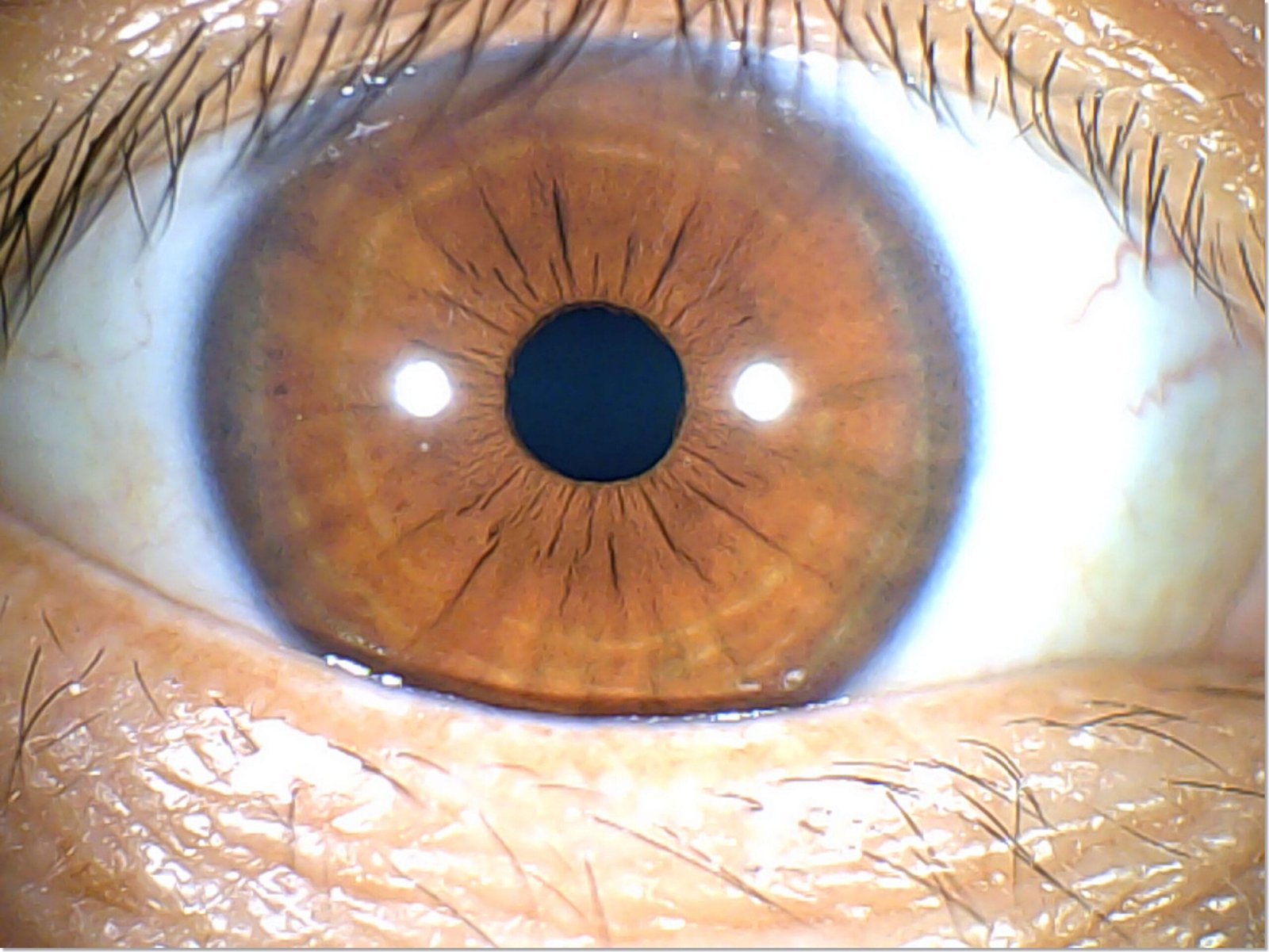 Mappa dell’Iridologia: Una Guida Completa per Comprendere l’Analisi dell’Iride