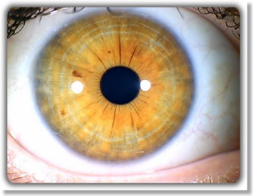 Mappa dell’Iridologia: Una Guida Completa per Comprendere l’Analisi dell’Iride 3 Mappa dellIridologia 2