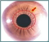 Chapter 3.2 3.1Stomach Ring 002