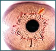 Chapter 3.3 The Autonomic Nerve Wreath ANW001