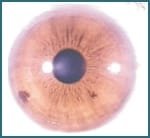 Eye structure and Iris functions008