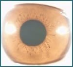 Eye structure and Iris functions009