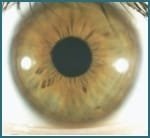 Eye structure and Iris functions010