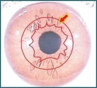 Illustration of Iridology 3.4 Internal Organ 001