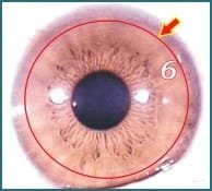 Illustrazione di Iridologia – 3.5 Il Sistema Linfatico
