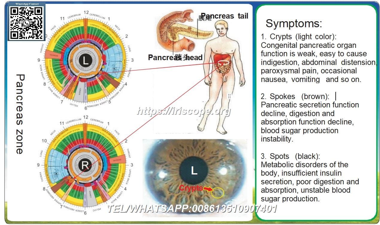 8.1 Iridologia – Zona Pancreatica: Segni dell'Iride e Disfunzioni Metaboliche 1 8.1 Iridologia – Zona Pancreatica: Segni dell'Iride e Disfunzioni Metaboliche