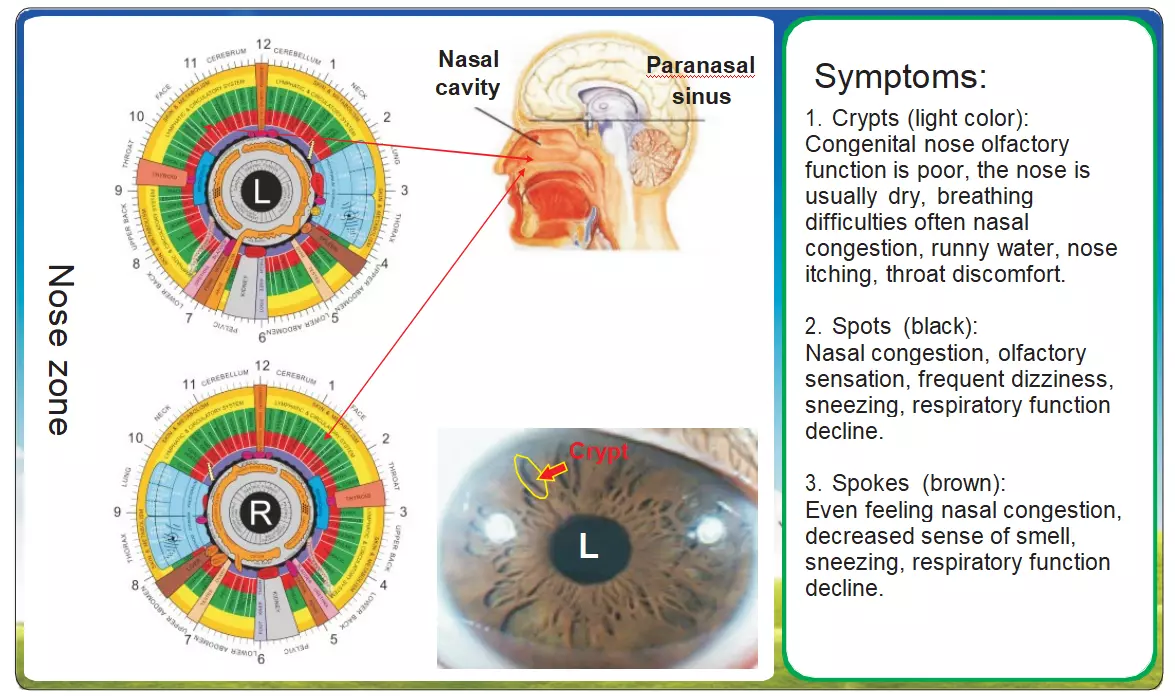 8.2 Iridologia del Sistema Respiratorio: Correlazioni Cliniche 1 8.2 Iridologia del Sistema Respiratorio: Correlazioni Cliniche