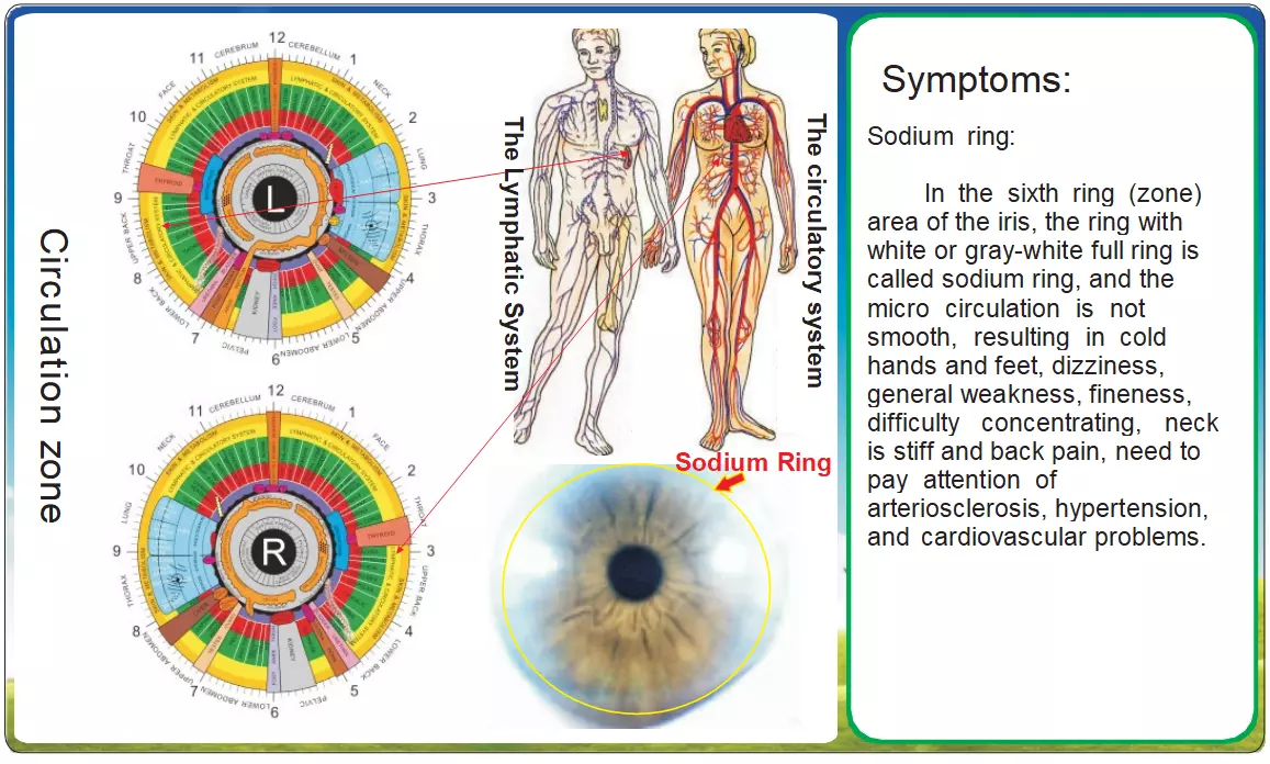 8.3 Iridologia e Sistema Circolatorio: Segni Oculari di Squilibri Sistemici