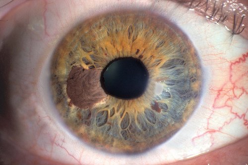 Iridoscopio professionale: quale scegliere per uso formativo e benessere in Italia — MAIKONG IRIDOLOGY CAMERA (1562).jpg