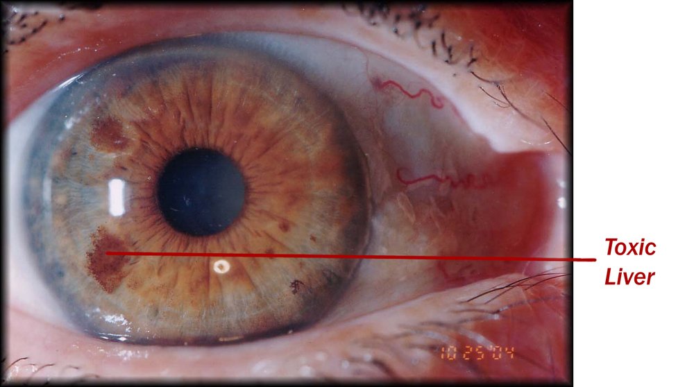 Vendita iridoscopi in Italia: guida pratica per operatori olistici che vogliono offrire il servizio — MAIKONG IRIDOLOGY CAMERA (1574).jpg