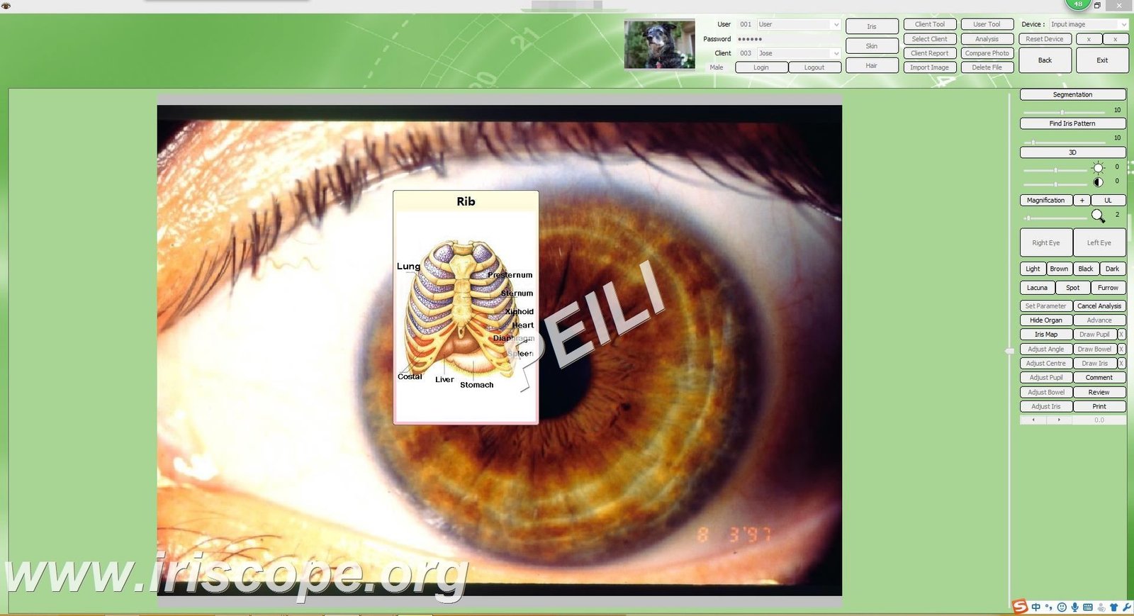 Fotocamera per iridologia MAIKONG