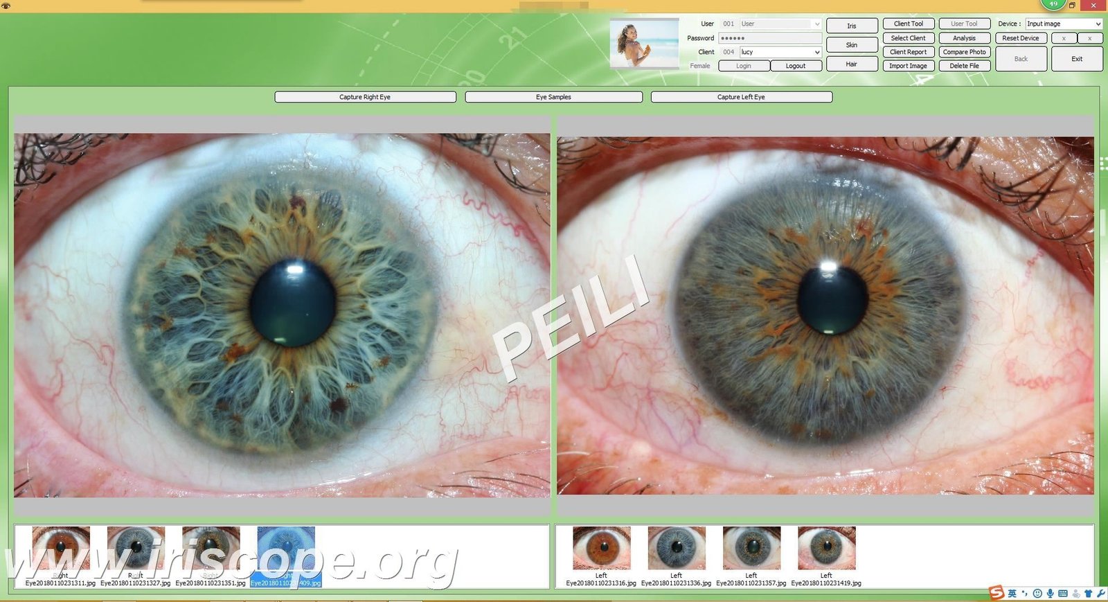Come localizzare il software MAIKONG per clienti e distributori in Italia: guida pratica e passaggi immediati 1 Come localizzare il software MAIKONG per clienti e distributori in Italia: guida pratica e passaggi immediati — MAIKONG IRIDOLOGY CAMERA (45).JPG