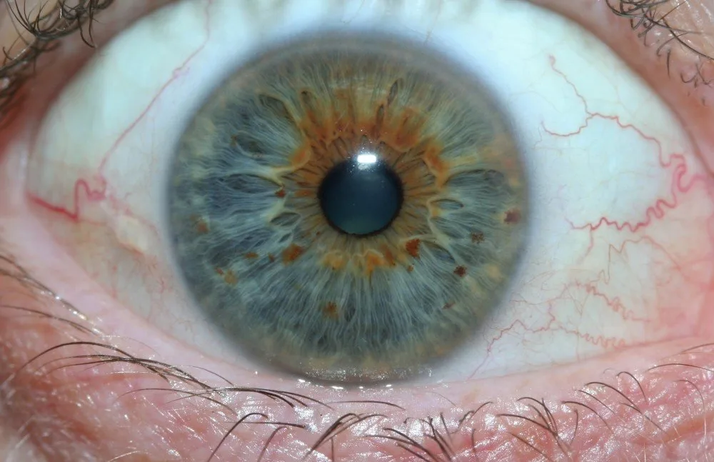 Where can a Venditori e acquirenti target in Italia: I potenziali venditori dei nostri iridoscopi MAIKONG comprendono importatori di — MAIKONG IRIDOLOGY CAMERA (1551).jpg