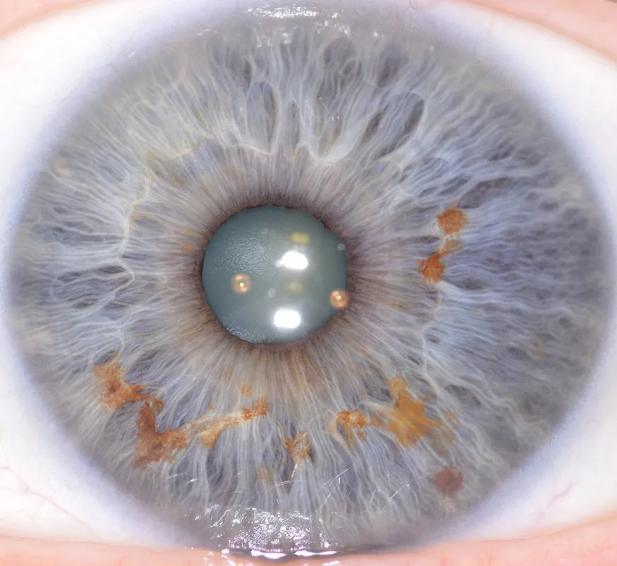 Where can a Venditori e acquirenti target in Italia: I potenziali venditori dei nostri iridoscopi MAIKONG comprendono importatori di — MAIKONG IRIDOLOGY CAMERA (1532).jpg