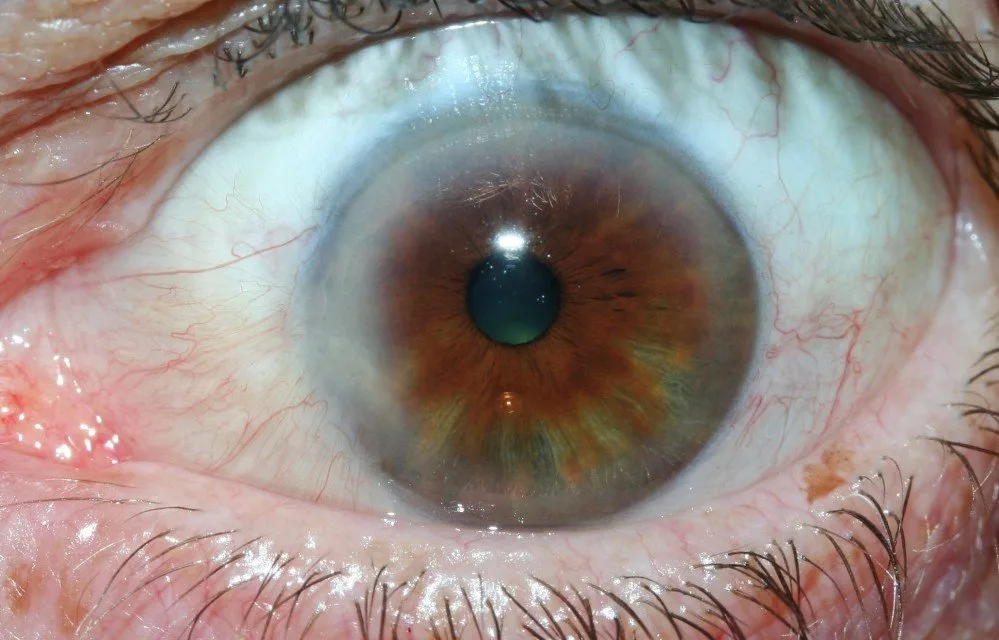 Where can a Venditori e acquirenti target in Italia: I potenziali venditori dei nostri iridoscopi MAIKONG comprendono importatori di — MAIKONG IRIDOLOGY CAMERA (1550).jpg
