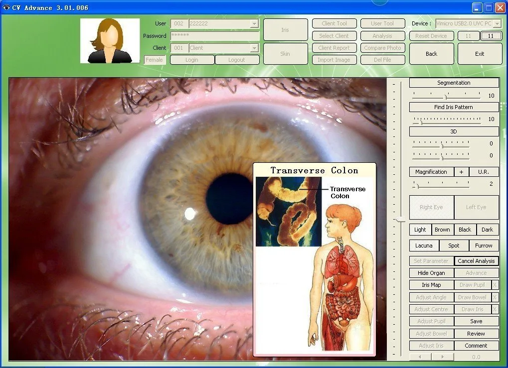What should buyers compare before purchasing iride significato? 8 What should buyers compare before purchasing iride significato? — MAIKONG IRIDOLOGY CAMERA (358).jpg
