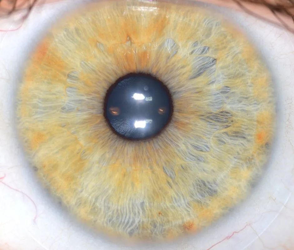 What should buyers compare before purchasing iride significato? 9 What should buyers compare before purchasing iride significato? — MAIKONG IRIDOLOGY CAMERA (1528).jpg