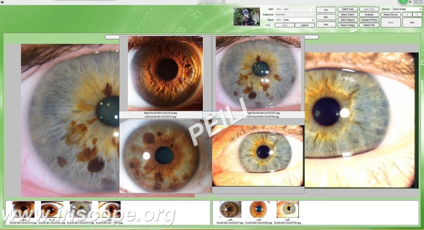 What should buyers compare before purchasing iride significato? 6 What should buyers compare before purchasing iride significato? — MAIKONG IRIDOLOGY CAMERA (40).JPG