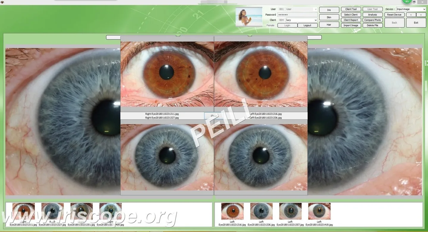 What should buyers compare before purchasing iride significato? 4 What should buyers compare before purchasing iride significato? — MAIKONG IRIDOLOGY CAMERA (46).JPG