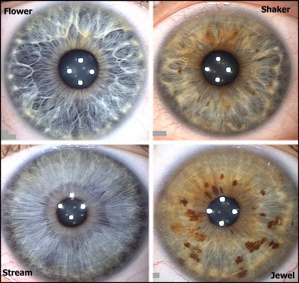 Iridologia in Italia: chi fornisce apparecchiature e dove trovare testimonianze — MAIKONG IRIDOLOGY CAMERA (1702).jpg