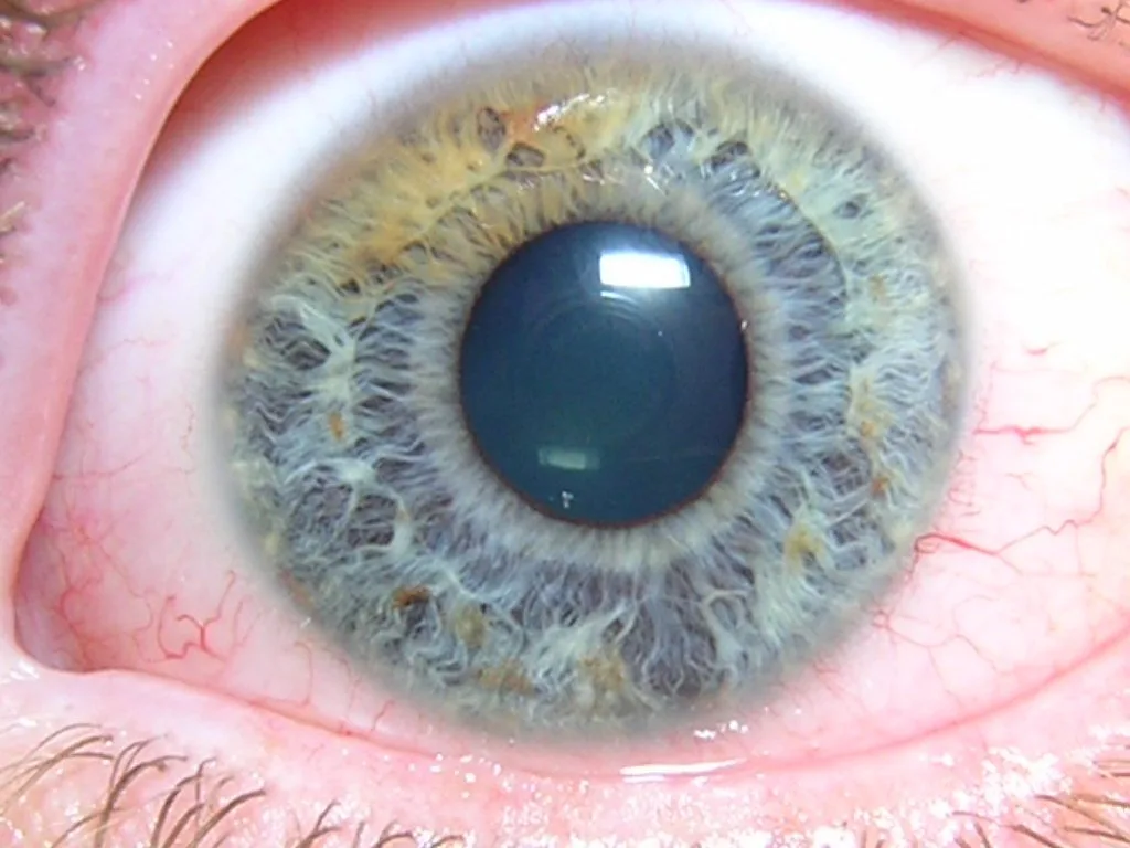 Iridologia in Italia: chi fornisce apparecchiature e dove trovare testimonianze — MAIKONG IRIDOLOGY CAMERA (1503).jpg