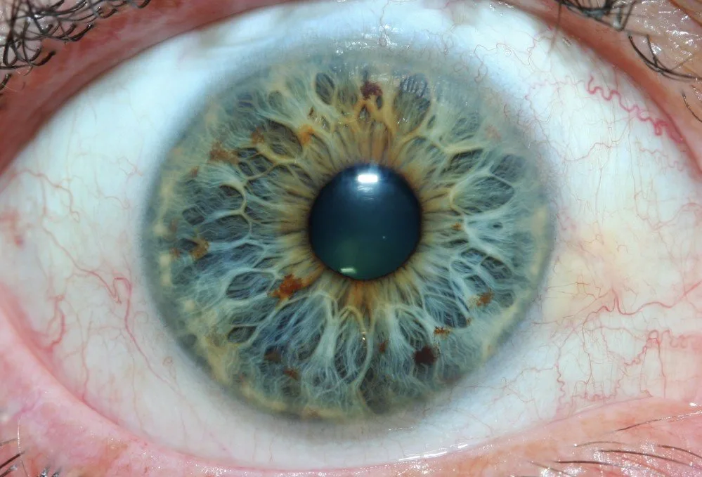 Iridologo medico un: fornitori leader di strumenti per l'iridologia nelle scuole e negli istituti di formazione — MAIKONG IRIDOLOGY CAMERA (1539).jpg