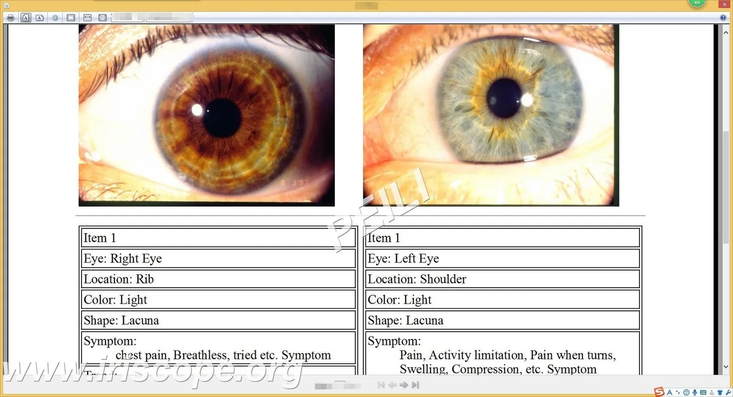 Iridoscopio per iridologia: quale scegliere e come usarlo in una SPA in Italia — MAIKONG IRIDOLOGY CAMERA (38).JPG