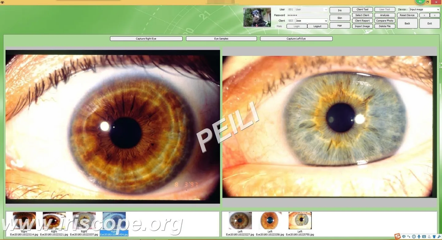 Iridoscopio per iridologia: quale scegliere e come usarlo in una SPA in Italia — MAIKONG IRIDOLOGY CAMERA (22).JPG