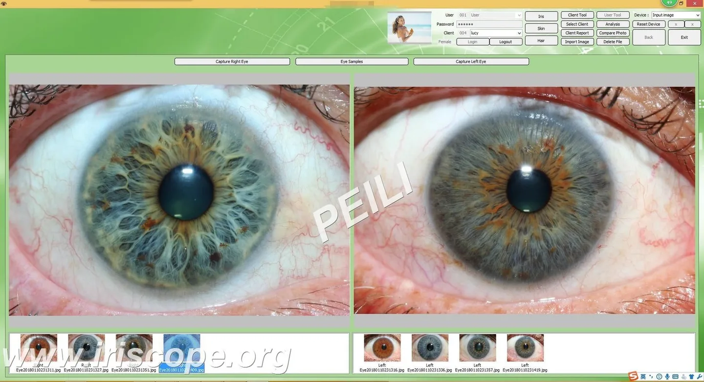 Iridoscopio per iridologia: quale scegliere e come usarlo in una SPA in Italia — MAIKONG IRIDOLOGY CAMERA (45).JPG