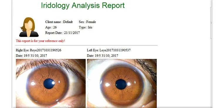 Iridoscopio per iridologia: quale scegliere e come usarlo in una SPA in Italia — appareil photo iridologie (20).jpg